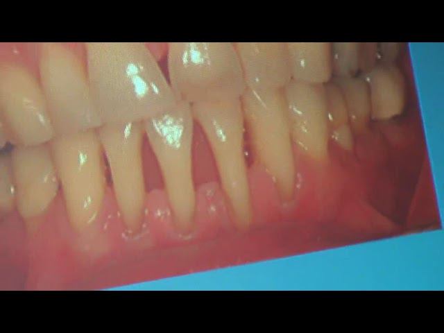 Семинар Краниосакральная терапия 2 КСТ2_017 смотреть онлайн