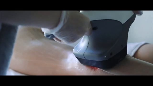 Аппаратная коррекция фигуры на Vela Smooth в Азбуке Лазер смотреть онлайн