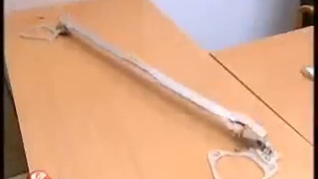 Распорки смотреть онлайн