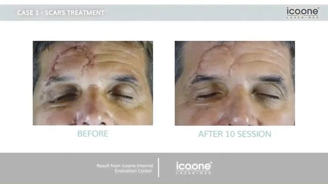 icoone Medical_ Laser Med смотреть онлайн