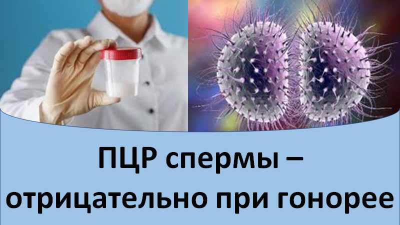Отрицательный анализ ПЦР спермы при гонорее смотреть онлайн