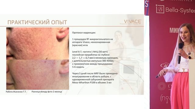 Доклад Пимоновой Анастасии и Исаченко Татьяны на конгрессе IECTC XII