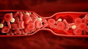 ЭТИ продукты БЫСТРО растворяют ТРОМБЫ в сосудах  Тромбоэмболия, варикоз, профилактика тромбоза