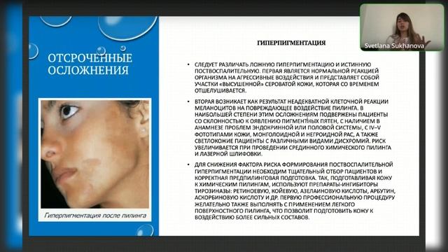 Вебинар 17.11.2022 Работа над ошибками. смотреть онлайн