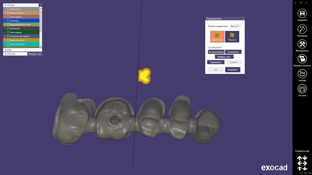 разделение зубных мостов на "Exocad" смотреть онлайн