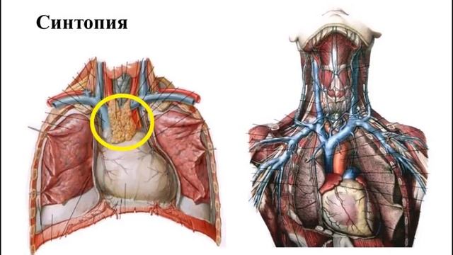 Верхняя полая вена: формирование, притоки, анастомозы смотреть онлайн