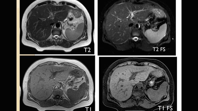 Тренировка для энергичного и продуктивного