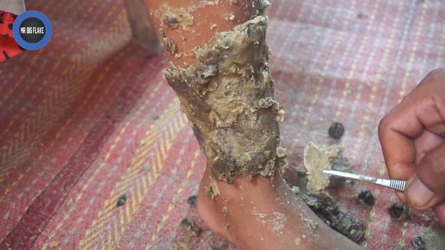 Dandruff Cleaning Worms #374 смотреть онлайн