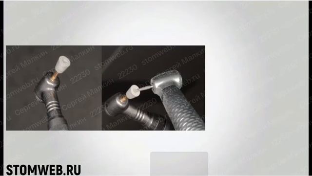 Полировка и Контурирование реставрации смотреть онлайн