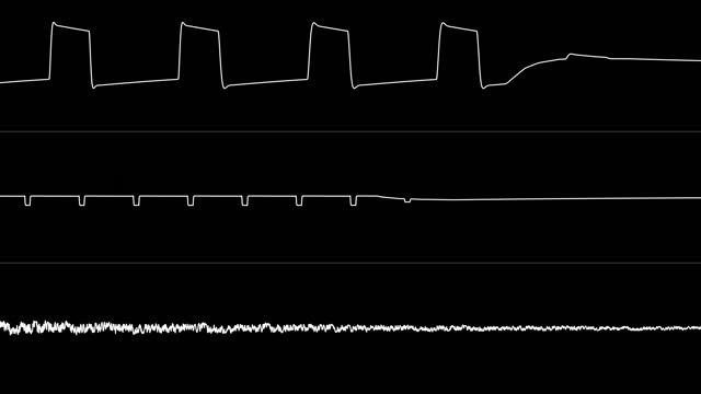 Dane - “Dane vs Deek” (C64) [Oscilloscope View] смотреть онлайн