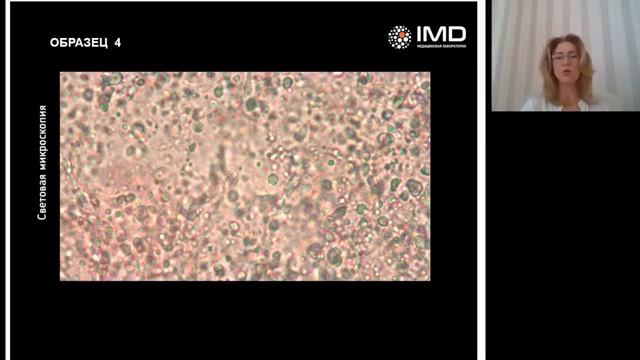 Вебинар для подологов. «Онихомикозы в подологии. Современные методы диагностики». смотреть онлайн