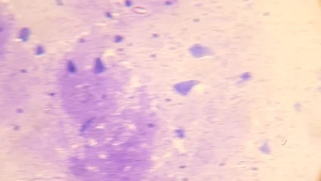 OBSERVONS L’INTÉRIEUR D'UN CERVEAU AU MICROSCOPE ! смотреть онлайн