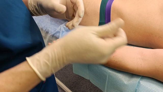 Липоматоз  Удаление липом из микроразрезов