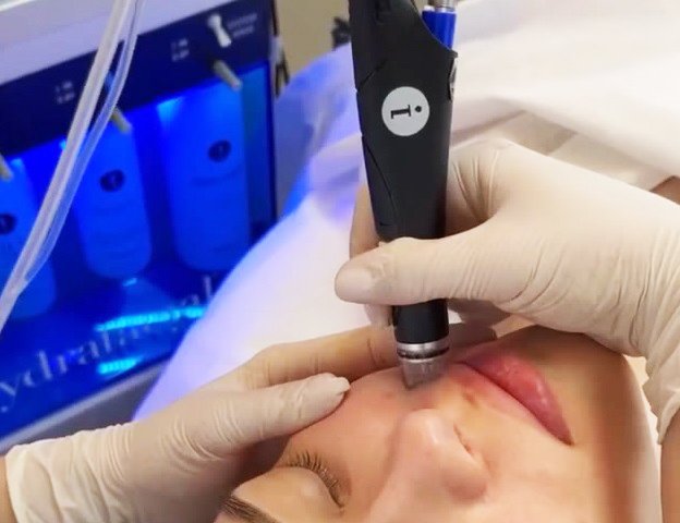 Hydrafacial - аппаратный комплексный уход за кожей смотреть онлайн