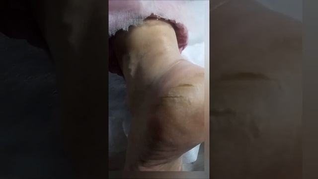 Для чего нужен смарт-педикюр смотреть онлайн