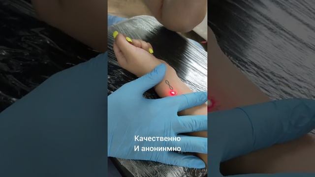 Удаление татуировки в Пятигорске смотреть онлайн