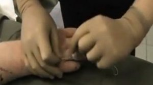 Как снять кольцо с пальца?