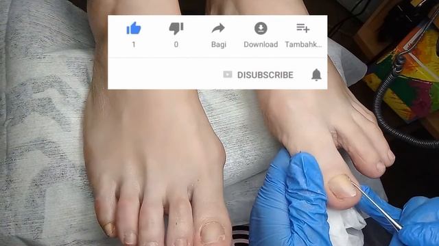 18... #аппаратныйпедикюр ,#тампонада смотреть онлайн