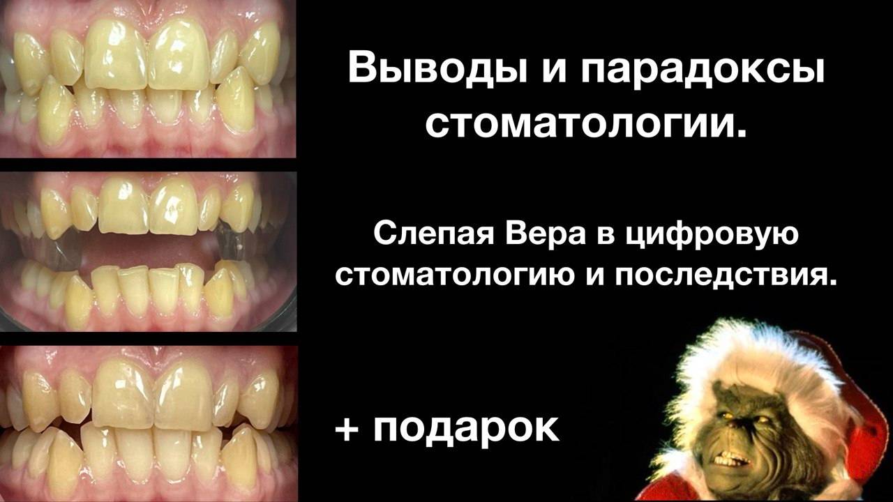 Парадокс в стоматологии. Чем лучше - тем, иногда, хуже - ДВНЧС - ВНЧС - НМР