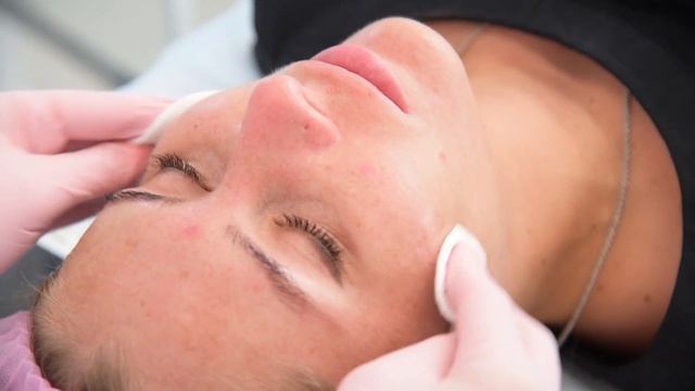 КАК УВЛАЖНИТЬ КОЖУ? ОБЗОР НА МЕЗОТЕРАПИЮ И КОММЕНТАРИЙ КОСМЕТОЛОГА