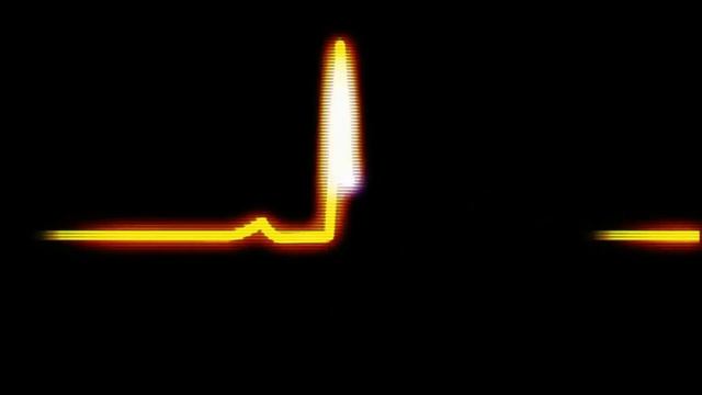How is Heart Rate Measured by a Chest Strap | Polar H10 Chest Strap | ECG & Pulse Rate Explained смотреть онлайн