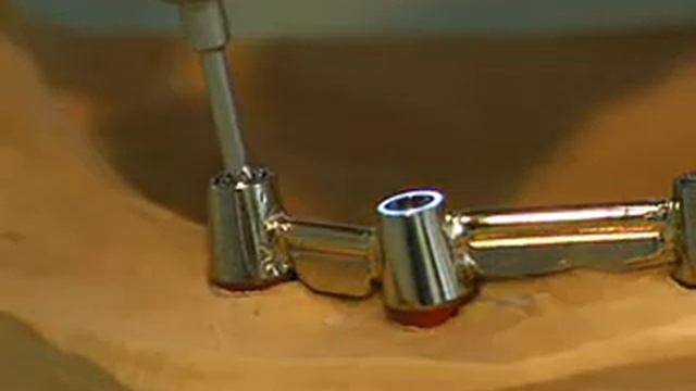 Изготовление съёмного протеза с балочной фиксацией на имплантах