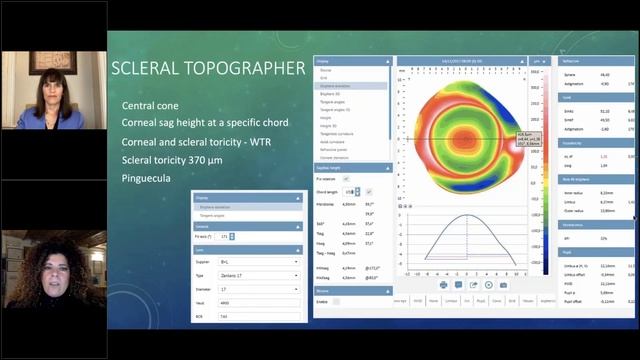 How to Customize Scleral Lenses 02/02/2021 смотреть онлайн