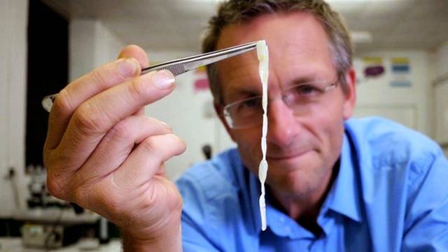 Глисты у детей симптомы смотреть онлайн