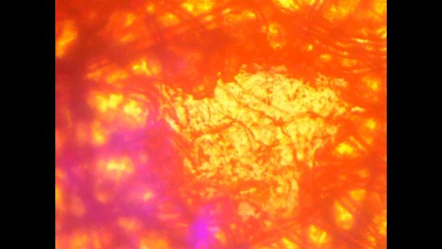 Поверхностная когерентно-некогерентная аналоговая колокализация в анализе РНВ 10х смотреть онлайн