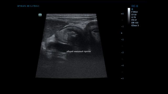 Парвовирусный энтерит у собаки смотреть онлайн