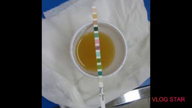 Why Negative urine pregnancy result in Tamil |Instructions for urine pregnancy test|Missed period смотреть онлайн