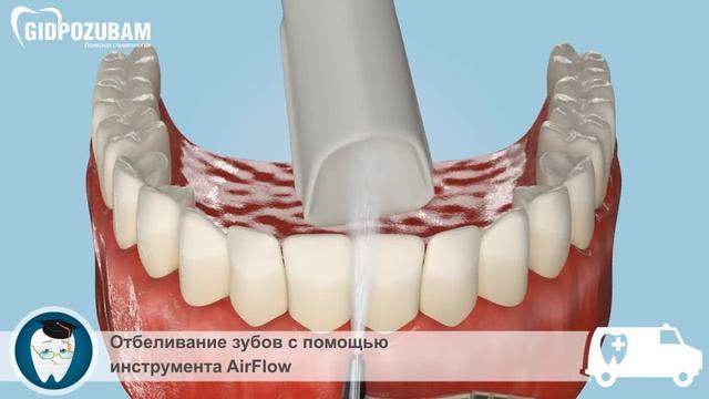 Чистка зубов AirFlow: этапы процедуры чистки налета на зубах смотреть онлайн