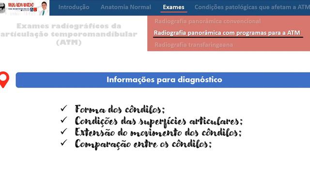 Técnicas e posicionamentos Radiograficos para ATM смотреть онлайн