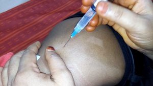 Diclofenac Sodium BP Injection And Ranitidine BP 50 mg/2 ml injection|Logic Bengali|