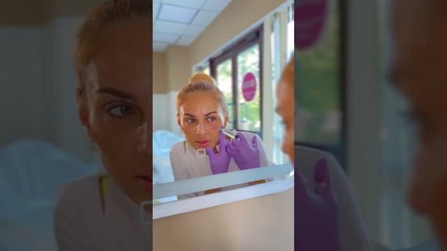 Что может случиться , если забыть намазать SPF крем. Устраняем пигментацию смотреть онлайн
