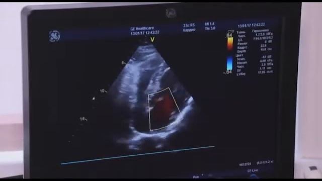 Рецепт Здоровья смотреть онлайн