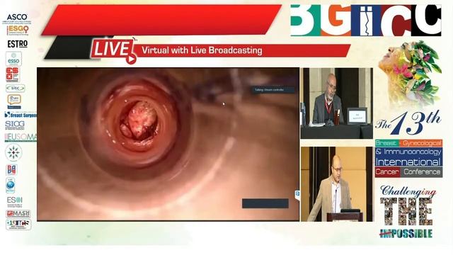 Minimally Invasive Inguinal Lymph Node Dissection смотреть онлайн