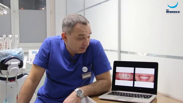 Керамические виниры на резцы Бутаев А.С. (Клиника Dr. Smile) смотреть онлайн