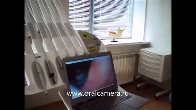 www oralcamera ru Внутрировые видеокамеры смотреть онлайн