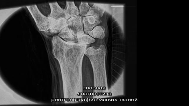 Рентген мягких тканей конечностей смотреть онлайн