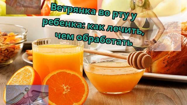 Ветрянка во рту у ребенка: как лечить, чем обработать смотреть онлайн