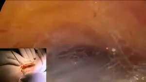 Остеопатия - удивительное видео