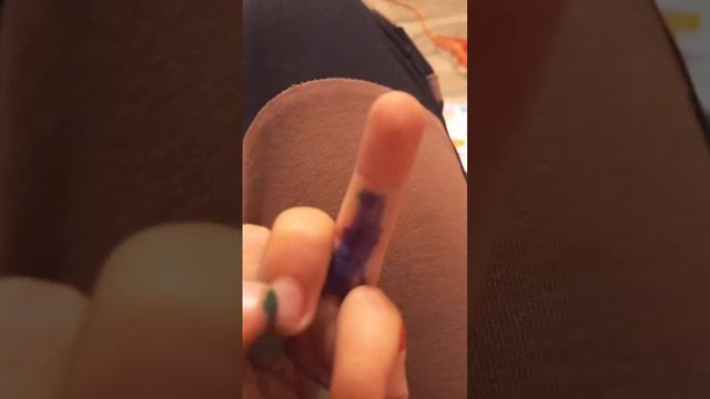 самое грязное место на моей руке смотреть онлайн