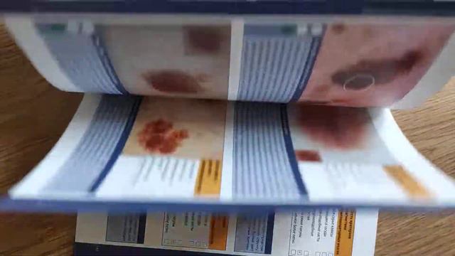 Дерматоскопия Питер Сойер смотреть онлайн