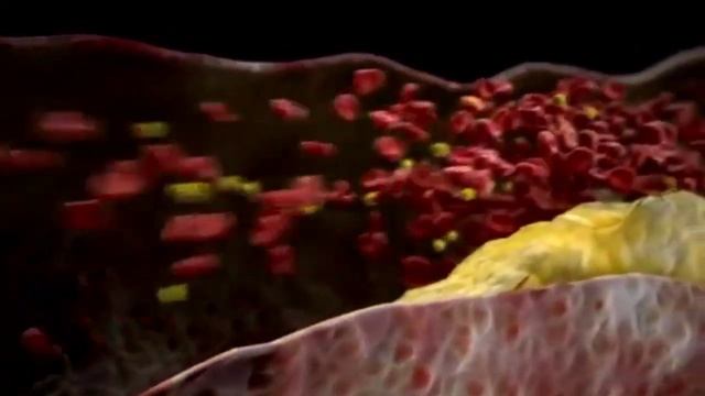 QON BOSIMINI O'LCHOVCHI ASBOBLARNI QANDAY TANLASH KERAK...! смотреть онлайн