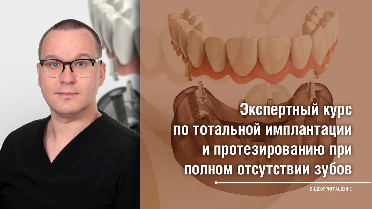 Приглашение Александра Данилова на серию онлайн-курсов по тотальной имплантации смотреть онлайн
