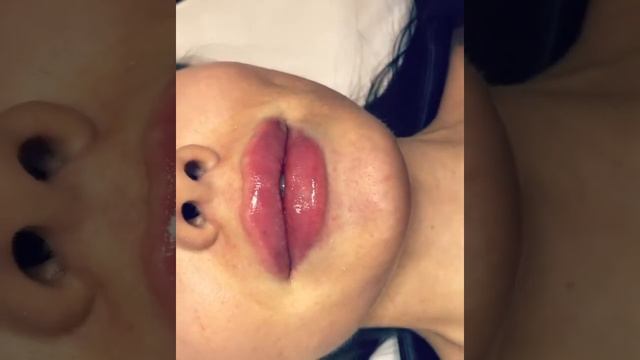 Увеличение губ смотреть онлайн