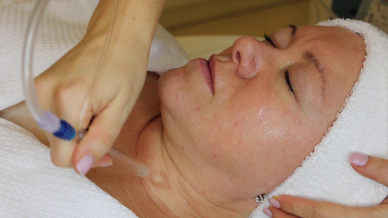 Jet Peel смотреть онлайн