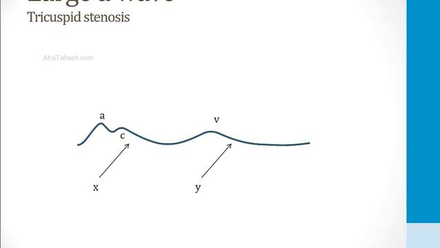 Cardiology - 1. Anatomy And Physiology - 8.Venous Pressure Tracings Atf