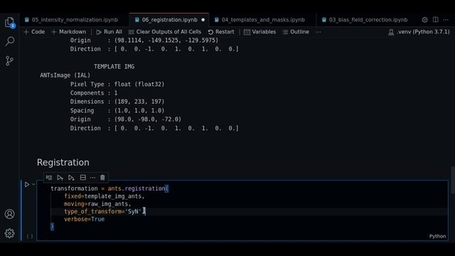 6.0 - MRI image registration with ANTsPy - Course MRI preprocessing with Python смотреть онлайн